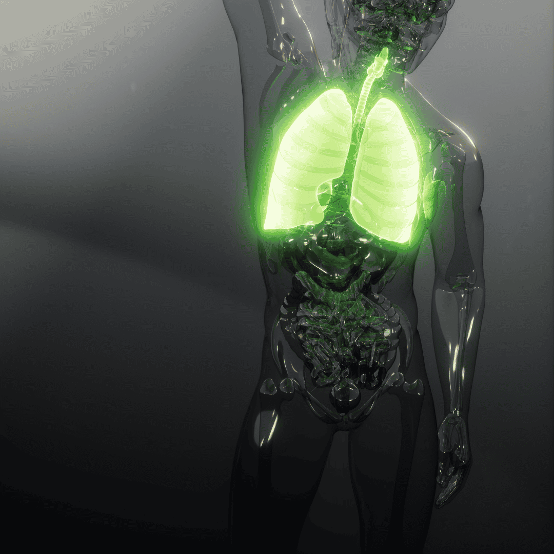 COPD Treatment through Stem Cells in Mexico